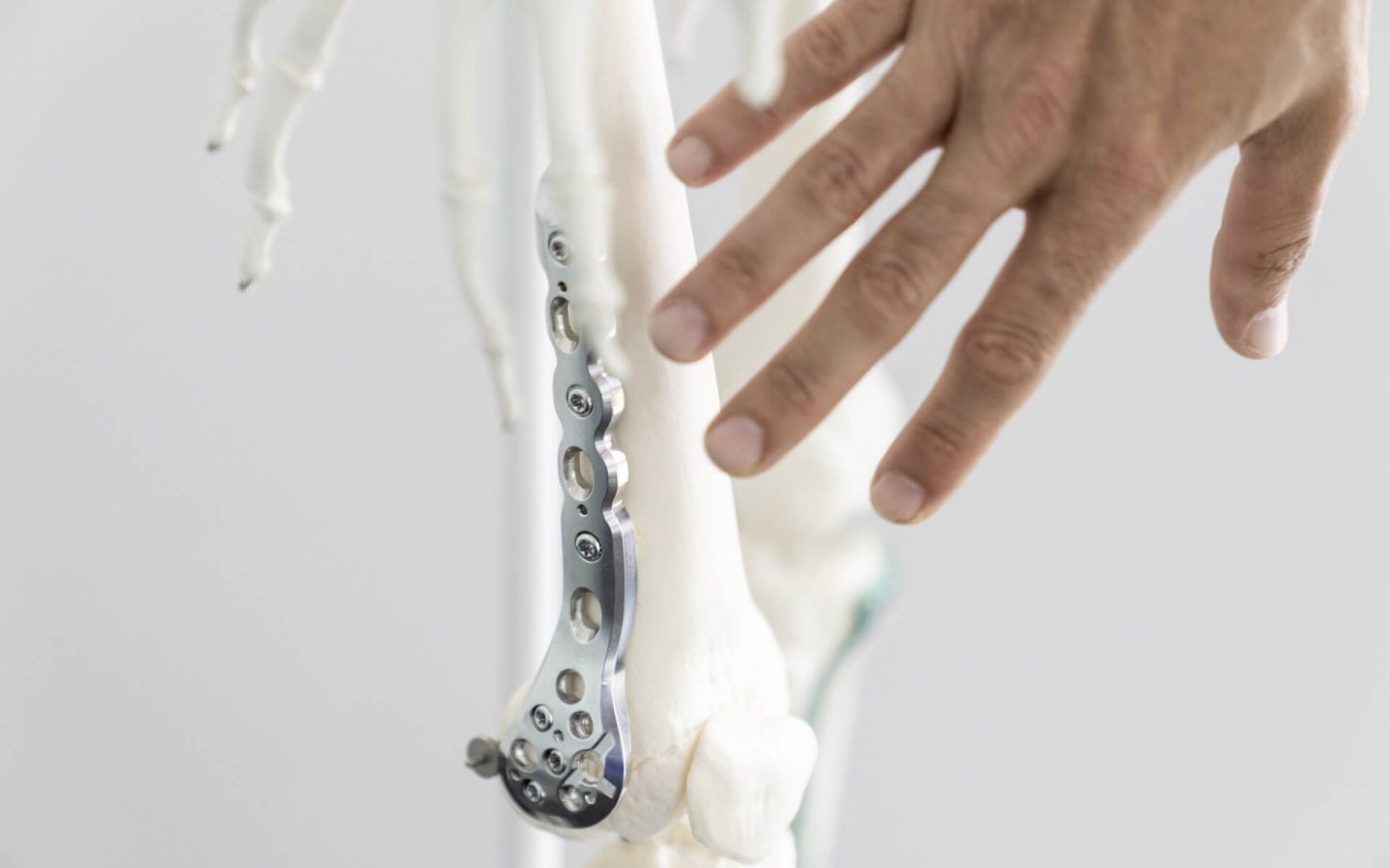 Wachsende Nachfrage nach künstlichen Hüft- und Kniegelenken: SMB Medical profitiert vom Boom des Prothesenmarkts.
